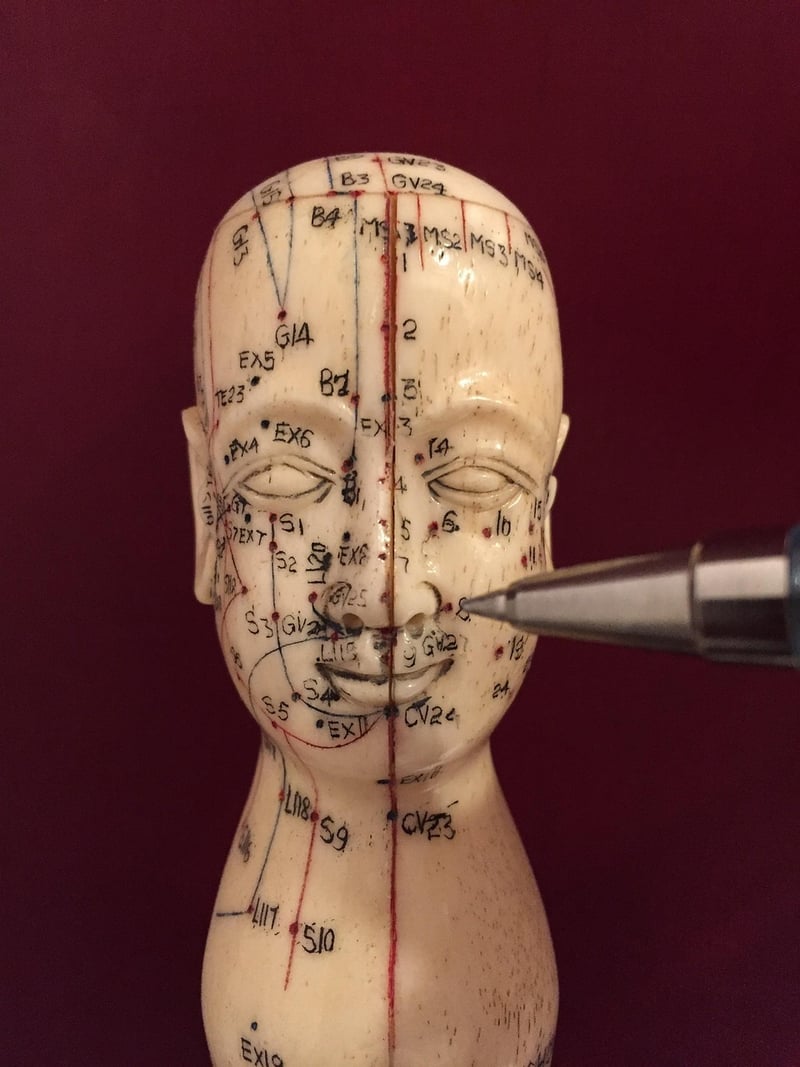 Acupuncture Therapy